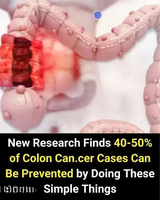 Simple Habits That Could Cut Your Risk of Colon Cancer by Half