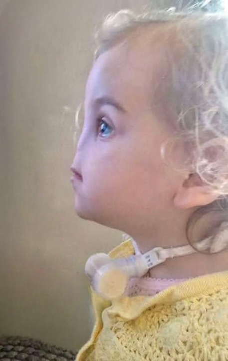 Tessa Evans’ Rare Condition: Her Journey of Strength and Resilience