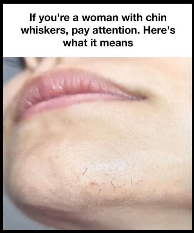 Understanding Chin Hair Growth! The Hair Growth Cycle and Hormonal Influence!